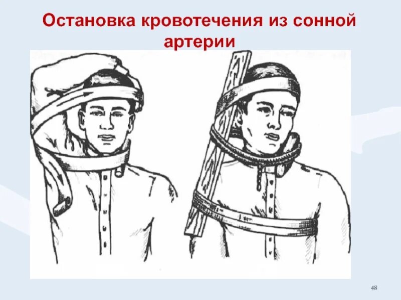 Как определить сонную артерию правильно