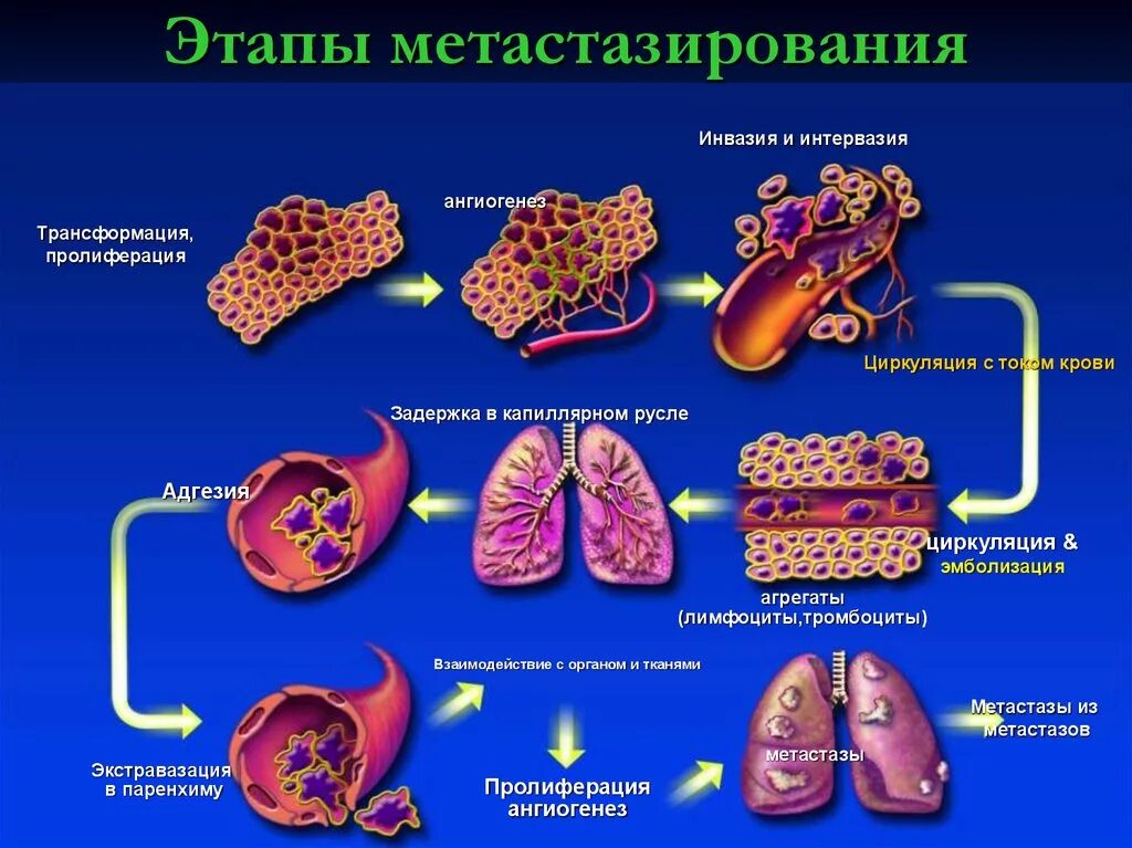 Механизмы развития метастазирования опухолей. Смешанный путь метастазирования. Пути метастазирования опухолей схема. Этапы метастазирования опухолевых клеток.