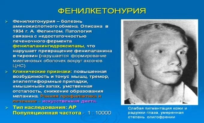 Мышиный запах заболевание