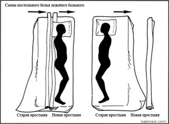 Смена постельного белья пациенту продольным способом. Продольная смена постельного белья. Смена постельного белья тяжелобольному. Способы смены белья. Смена постельного белья у тяжелобольного пациента.