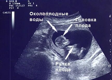 12 недель вес