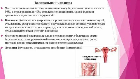 Молочница перед родами