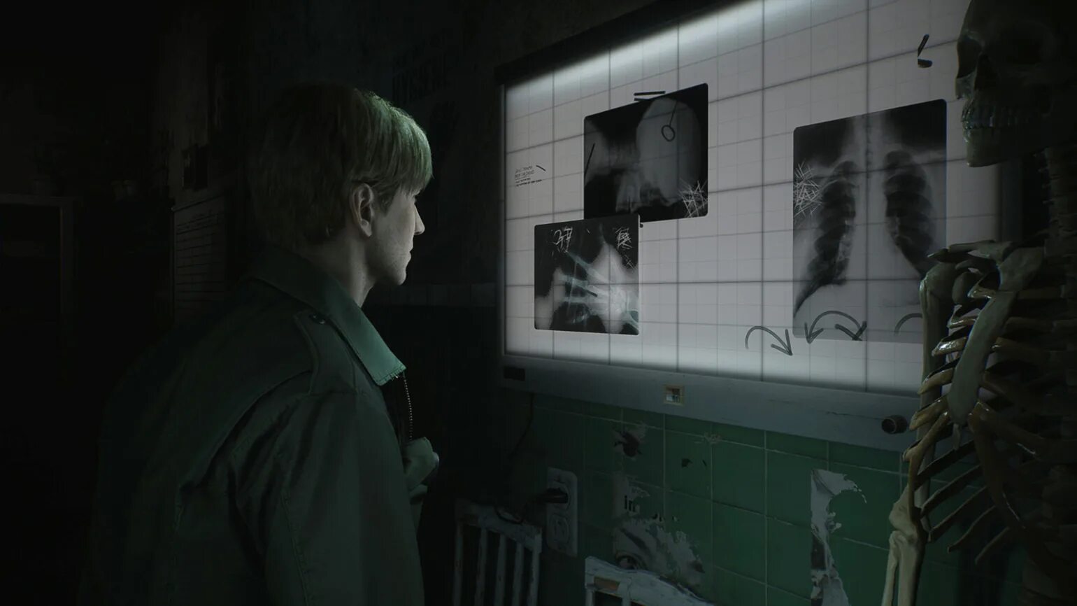 Silent hill 2 remake дата выхода. Silent hill 2 remake дата выхода