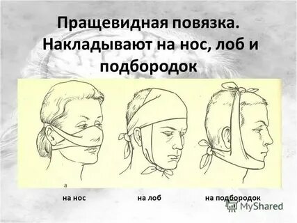 При повреждение носа повязки
