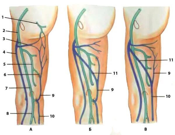 Алтах вена. Малая подкожная Вена Вена Джиакомини. Малая подкожная Вена (v. saphena Parva). Вена Джакомини варикоз.
