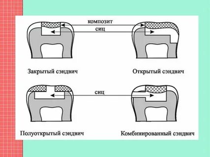 Закрытые полости