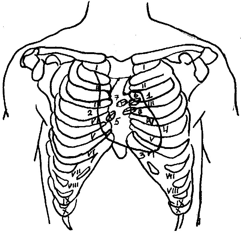 Топография сердца скелетотопия. Границы сердца скелетотопия. Топография сердца межреберья. Скелетотопия клапанов сердца. Клапаны сердца на грудной клетке