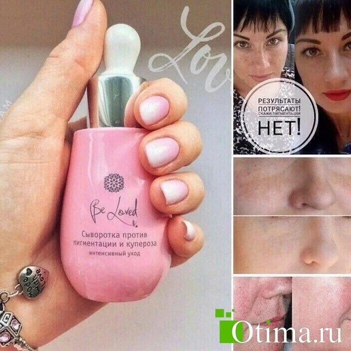 Витэкс сыворотка для лица. Dark spot correcting serum. Be loved сыворотка против пигментации и купероза. Сыворотка против пигментации нл. Сыворотка против пигментации орифлейм 33108.