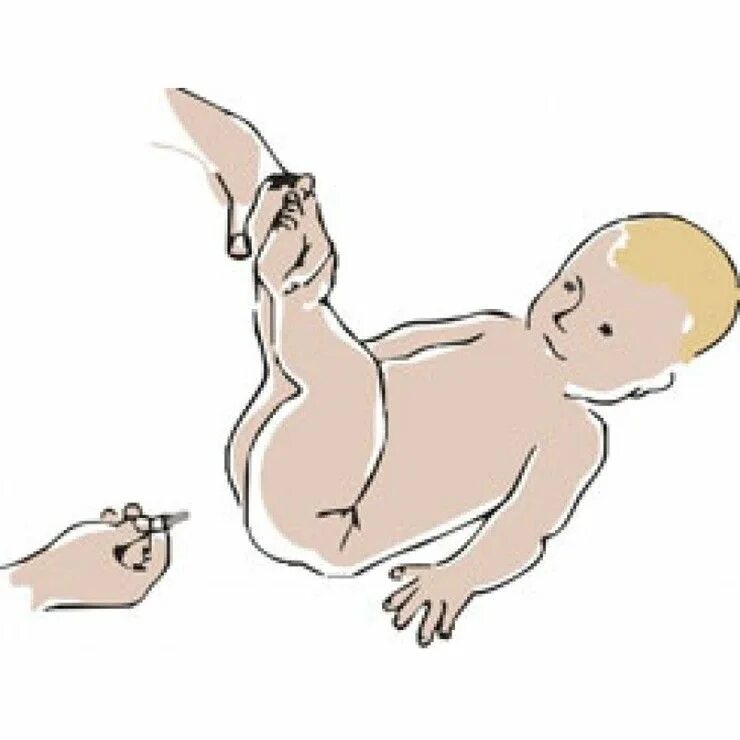 Как часто можно клизму новорожденному. Позы для отхождения газов у новорожденных. Клизмочку для новорожденного ребенка. ГАЗЫ У грудничка.