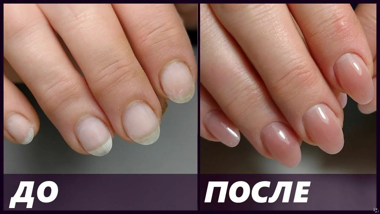 полигель и акригель. наращивание на верхние формы полигелем. можно укреплять ногти полигелем. наращивание ногтей акригелем на верхние формы. наращивание полигелем.