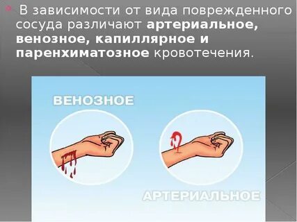 Способы остановки венозного кровотечения