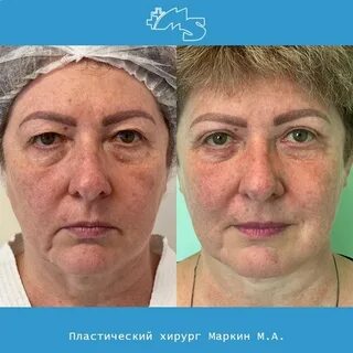 Сколько вам лет пластический