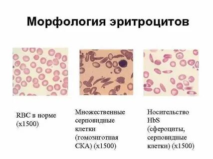 Эритроциты rbc норма