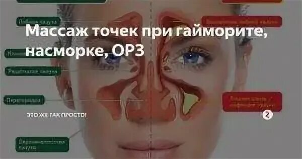 Гайморит сам проходит. Точечный массаж при синусите. массаж гайморовых пазух. точки гайморовых пазух. точечный массаж при гайморите.