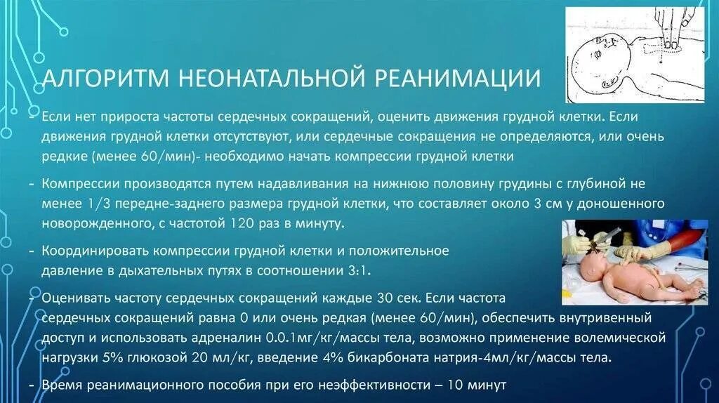 Алгоритм при асфиксии новорожденного. Алгоритм неонатальной реанимации. реанимация новорожденного алгоритм. алгоритм сердечно легочной реанимации у новорожденного. алгоритм выполнения слр у новорожденных.