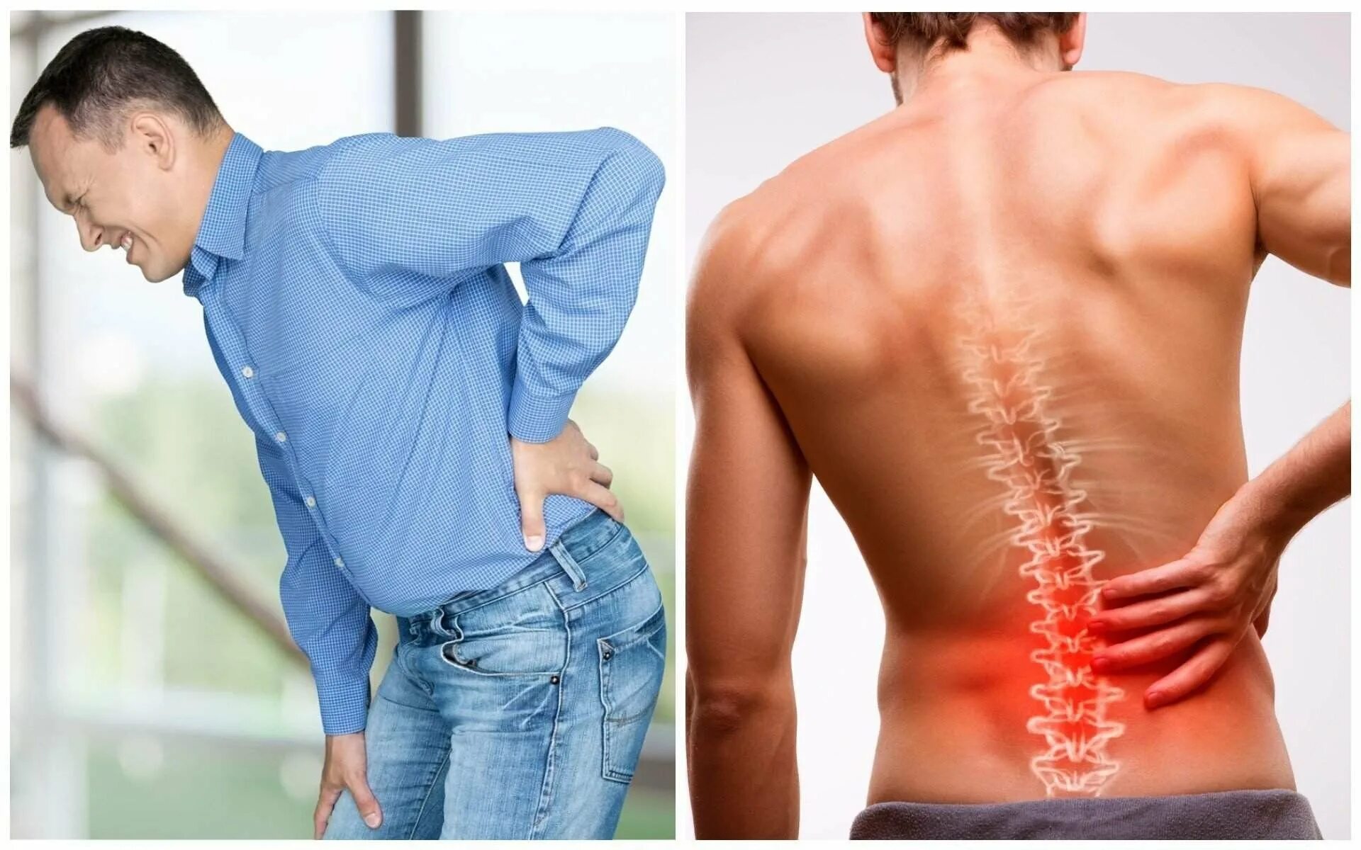 Болит спина сильно болит боль спины