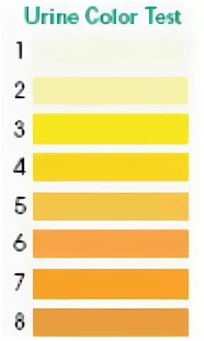 Почему моча ярко лимонного. Шкала цвета мочи. Цвет мочи норма. Желтый цвет мочи. Моча светло соломенного цвета.