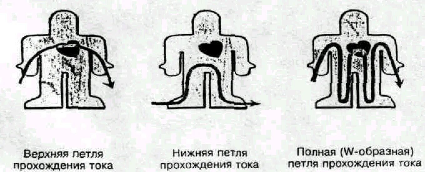 Какие петли тока наиболее опасны. Путь («петля») тока через тело человека. Пути прохождения электрического тока. Пути прохождения электрического тока через тело. Прохождение тока через тело человека.