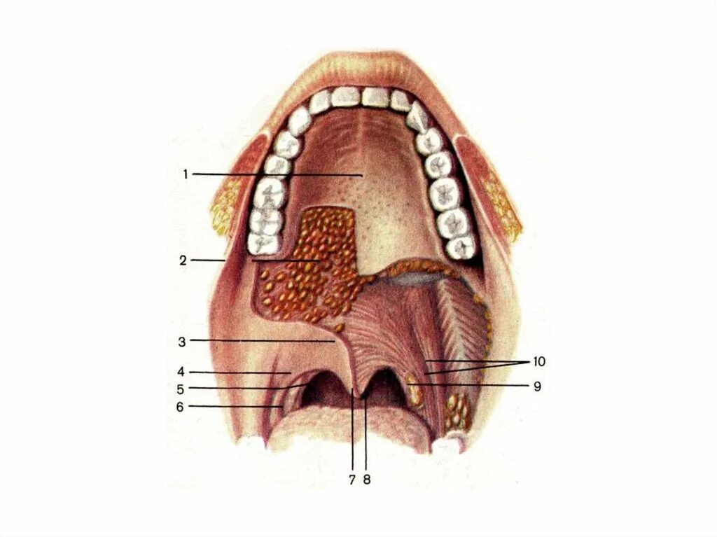 Отверстия полости рта. Небные железы (glandulae Palatinae). На небно глоточной дужке тонзиллит.