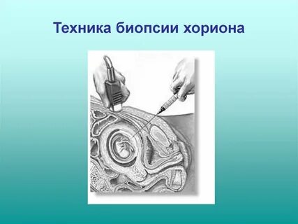 Ткани плода