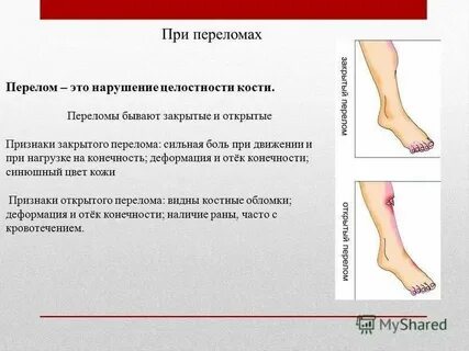 Травма верхних и нижних конечностей