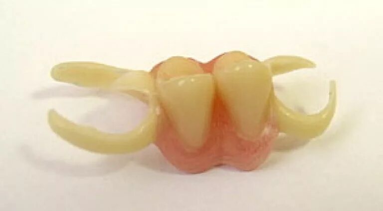 Нейлоновый микропротез 1-3 зуба. Бюгельный микропротез на 1 зуб. Съемный микропротез 1 зуб.