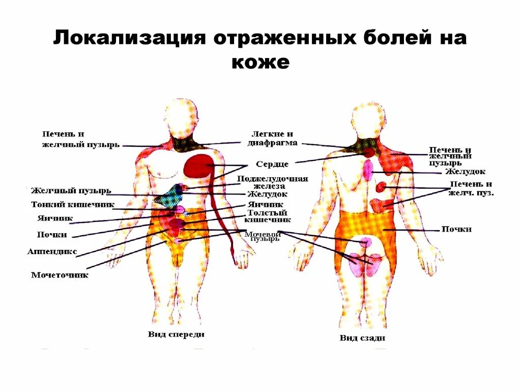 Заболевания локализация боли. Локализация боли в спине. Локализация боли в сердце. Локализация боли и причины. Локализация ьоливспине.