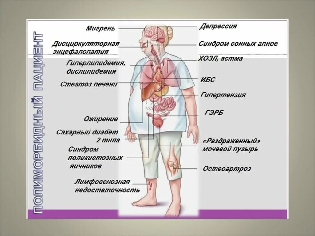 Комордонные заболевания. Коморбидность заболеваний. Коморбидная патология это. Коморбидность презентация. Коморбидный пациент это