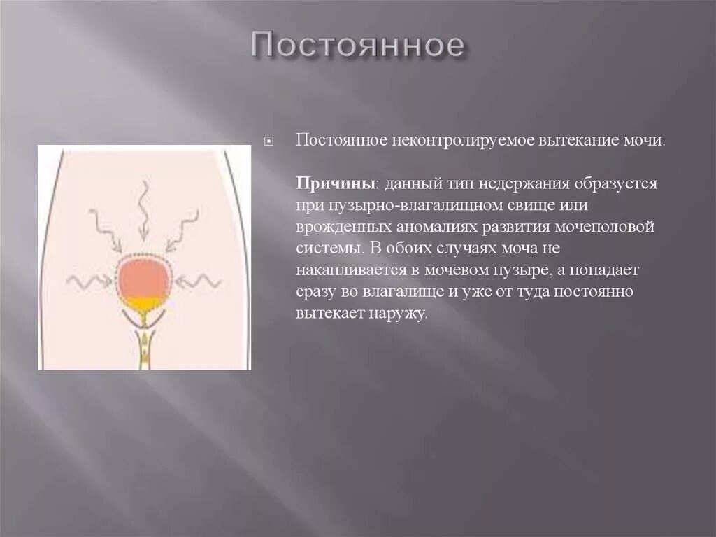 После мочеиспускания выделяется моча. Моча из мочевого пузыря. Накапливается в мочевом пузыре. Остаточная моча в мочевом пузыре в мл.