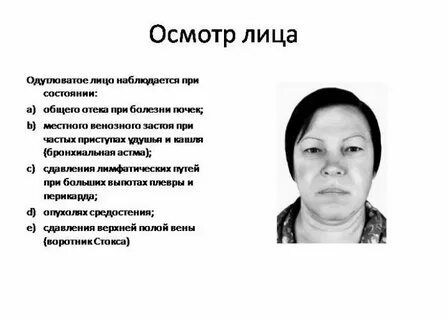 Лица по состоянию здоровья в г