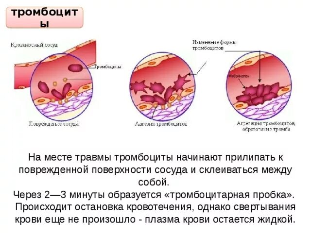 При повреждении сосудов тромбоциты. Тромбоциты процесс свертывания крови. Тромбоциты повреждение сосуда схема. Тромбоциты образование тромба. Тромбоциты останавливают кровотечение.