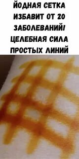 Йодовая сеточка