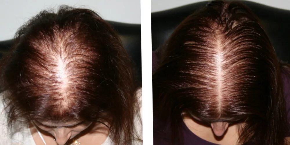 Лечение кожи головы отзывы