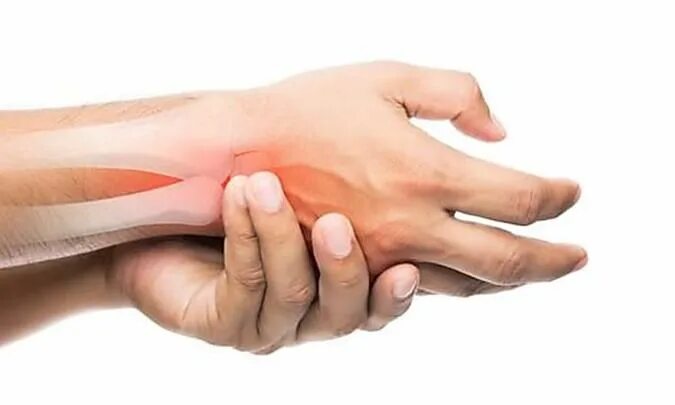 Dupuytren's Contracture Facts and Statistics: What You Need to Know