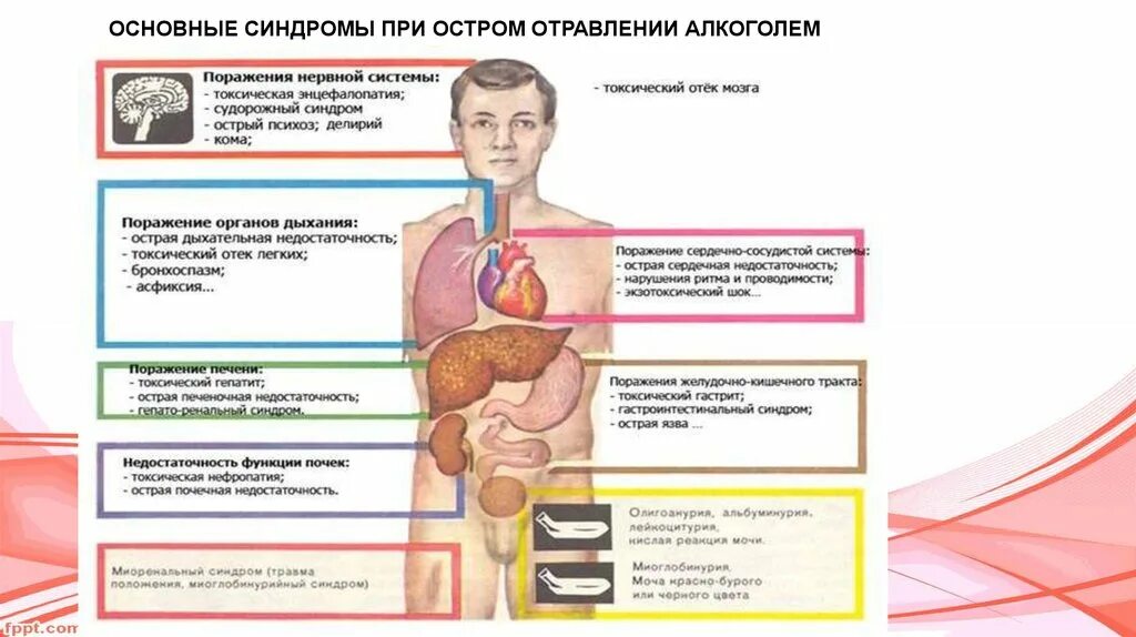 Острая алкогольная интоксикация. Клинические симптомы острых отравлений. Проявления алкогольной интоксикации. Алкогольная интоксикация симптомы. Токсическое поражение симптомы