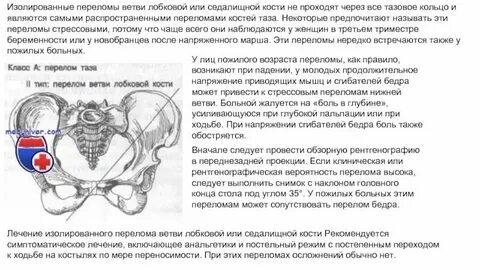 Перелом лобковой кости у женщин пожилого