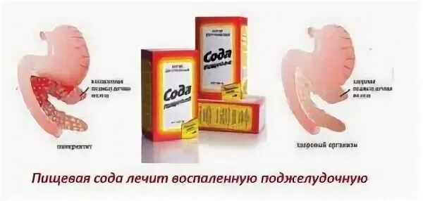 Сода при воспалениях