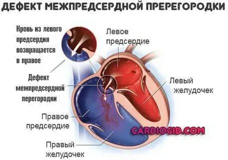 Открытое овальное окно отличие от дмпп