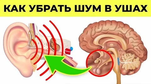 Шумит в ухе слева