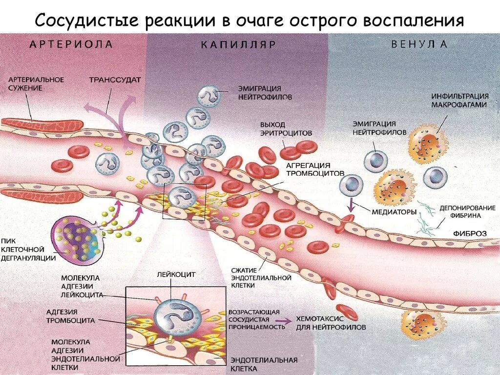 Сосудистые реакции в очаге воспаления патофизиология. Патогенез воспаления патофизиология. Сосудистые реакции в очаге острого воспаления. Сосудистые реакции при воспалении патофизиология. Реакция организма клетки на