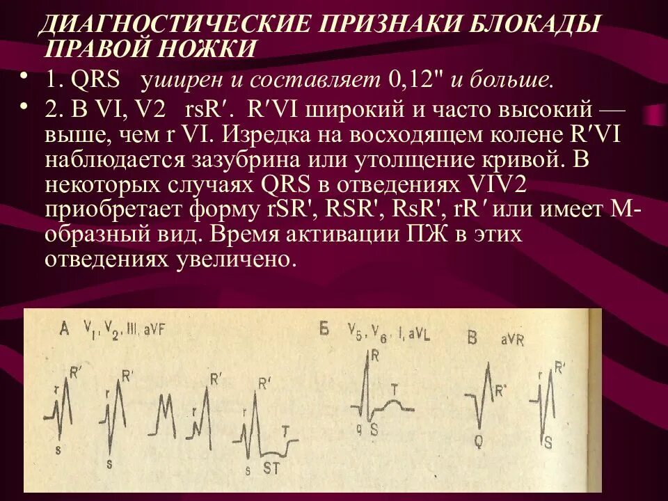 Неполная блокада ножек и ветвей пучка гиса