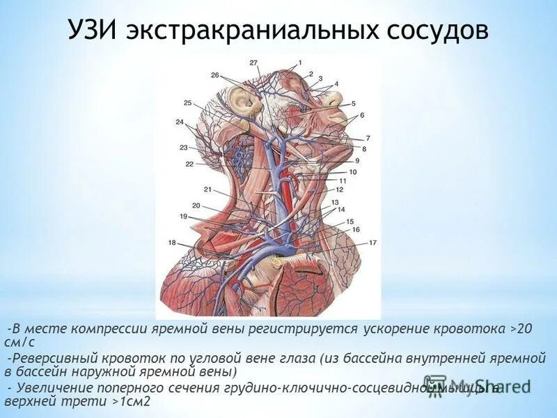 Венозная дисциркуляция головного мозга