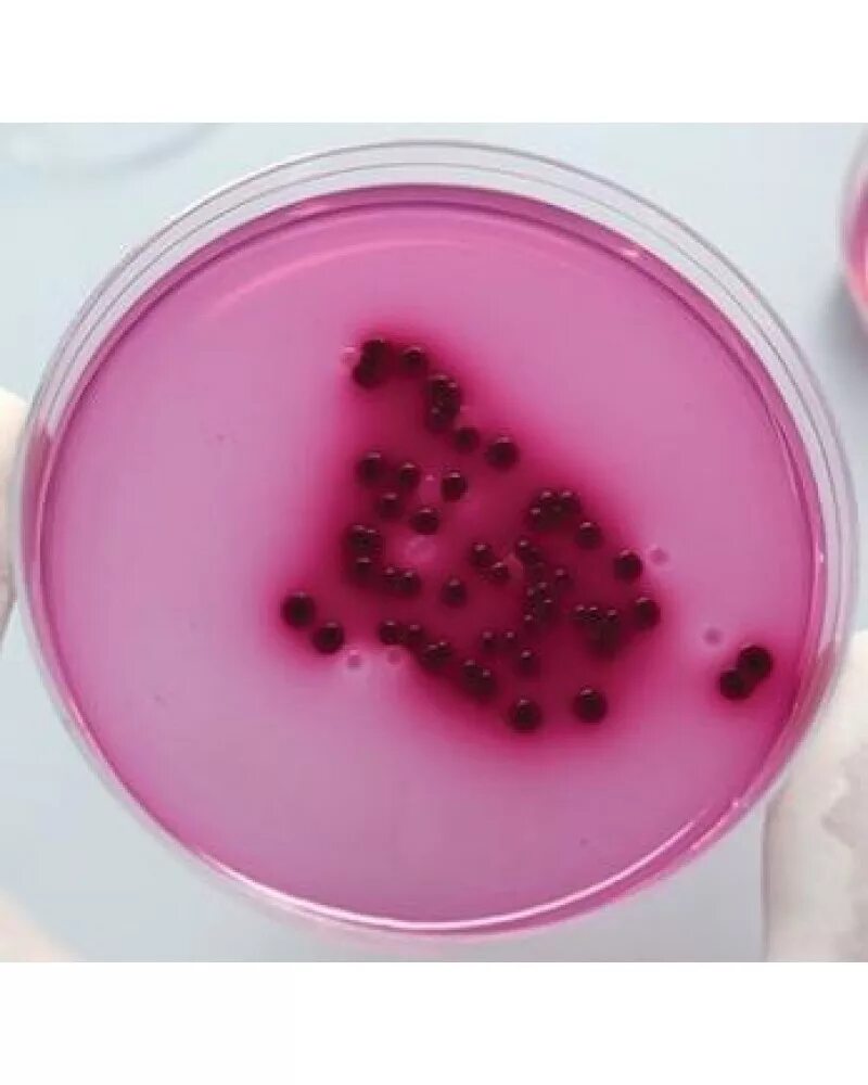 бактериологический метод сальмонеллеза. среда накопления для сальмонелл. сальмонеллы на селенитовой среде. среда накопления для сальмонелл. среда xld агар рост сальмонелл.