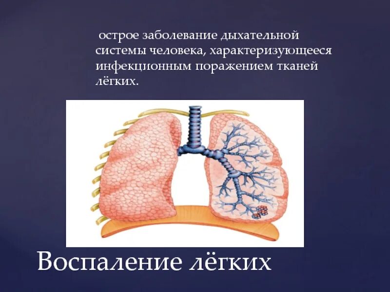 Поражение тканей легких. Воспаление тканей легких. Острые заболевания легких. Нагноения легочной ткани лекция. Как воспаляются легкие.