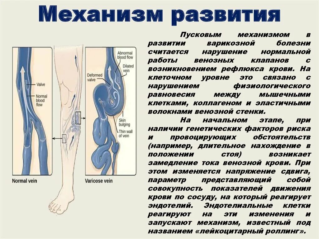 Мкб варикозная болезнь вен нижних