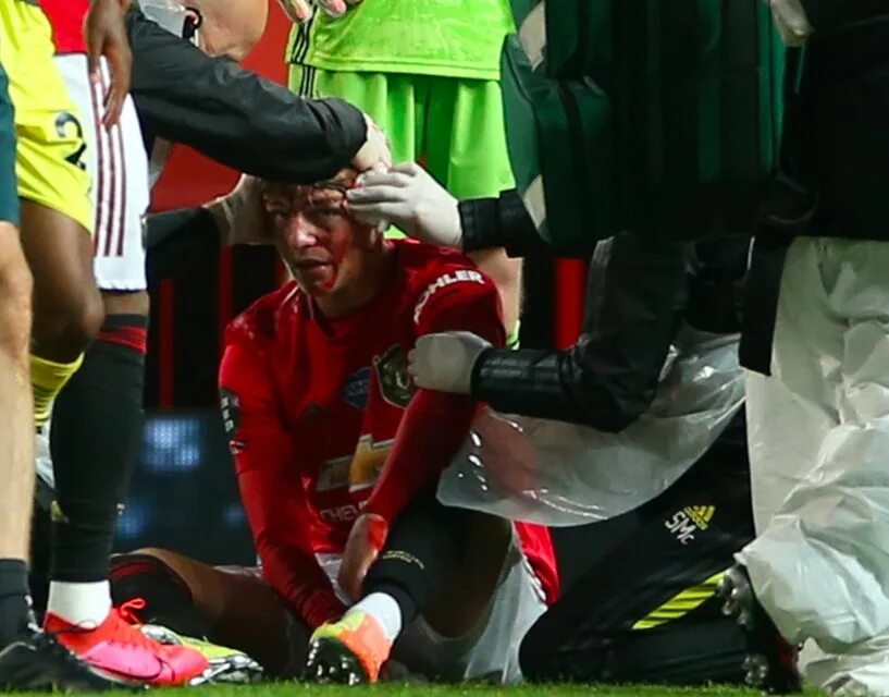 Правое нападение. Перелом ноги Манчестер Юнайтед. Травма Педри Манчестер. Манчестер Юнайтед спорит с судьей.