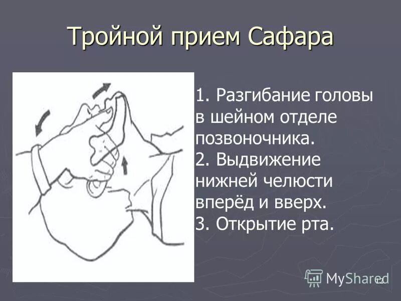 Тройной прием алгоритм. Сердечно легочная реанимация тройной прием Сафара. Тройной прием Сафара алгоритм.