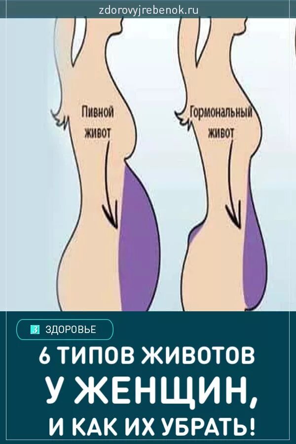 Как избавиться от кортизолового живота. Гормональный живот. виды живота у женщин. разновидности женских животов.