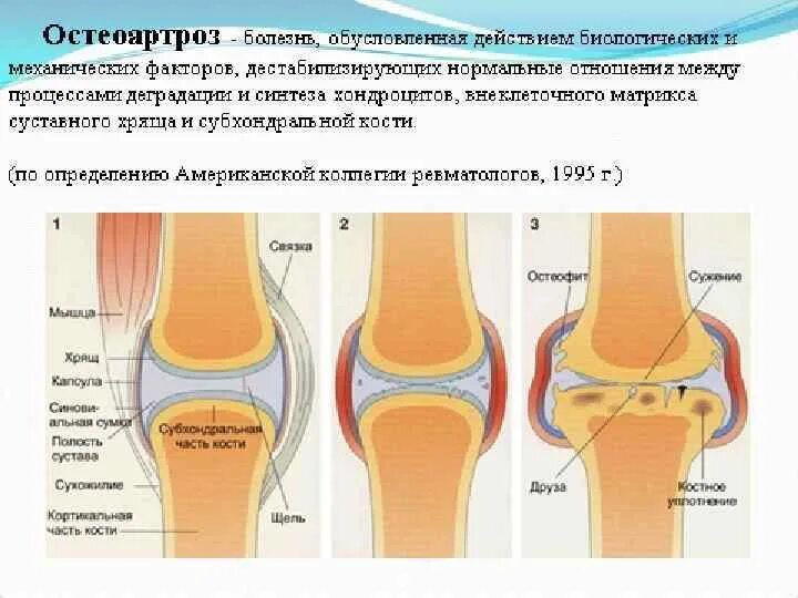 Дистрофические изменения позвоночника. Дегенеративно-дистрофические изменения. Дегенеративные изменения грудного отдела. Дегенеративные заболевания позвоночника. Дегенеративно дистрофическая болезнь позвоночника.