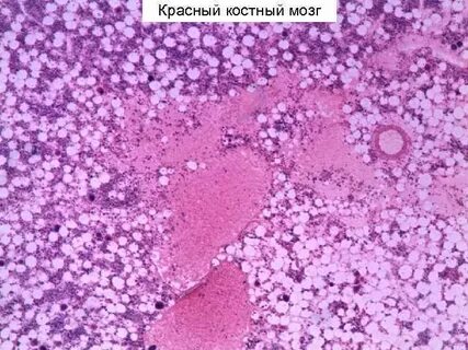 Костный препарат
